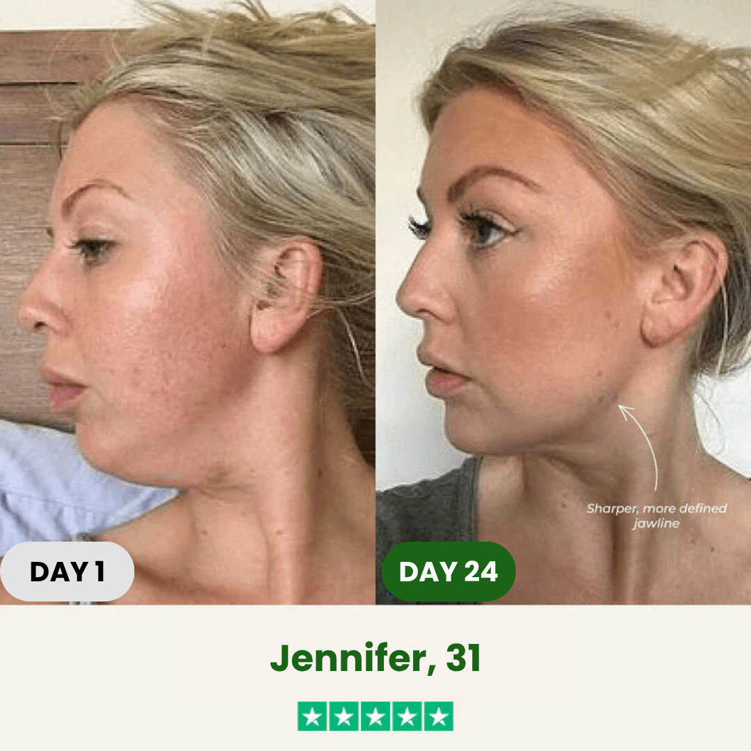 SCULPTA Jawline Kit®